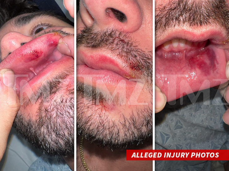 Jack Doherty 2 -- Sued for Assault and Battery For Bodygaurd