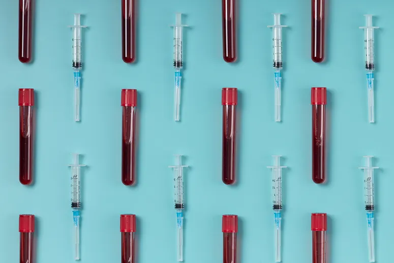 Overhead view of blood vials and needles