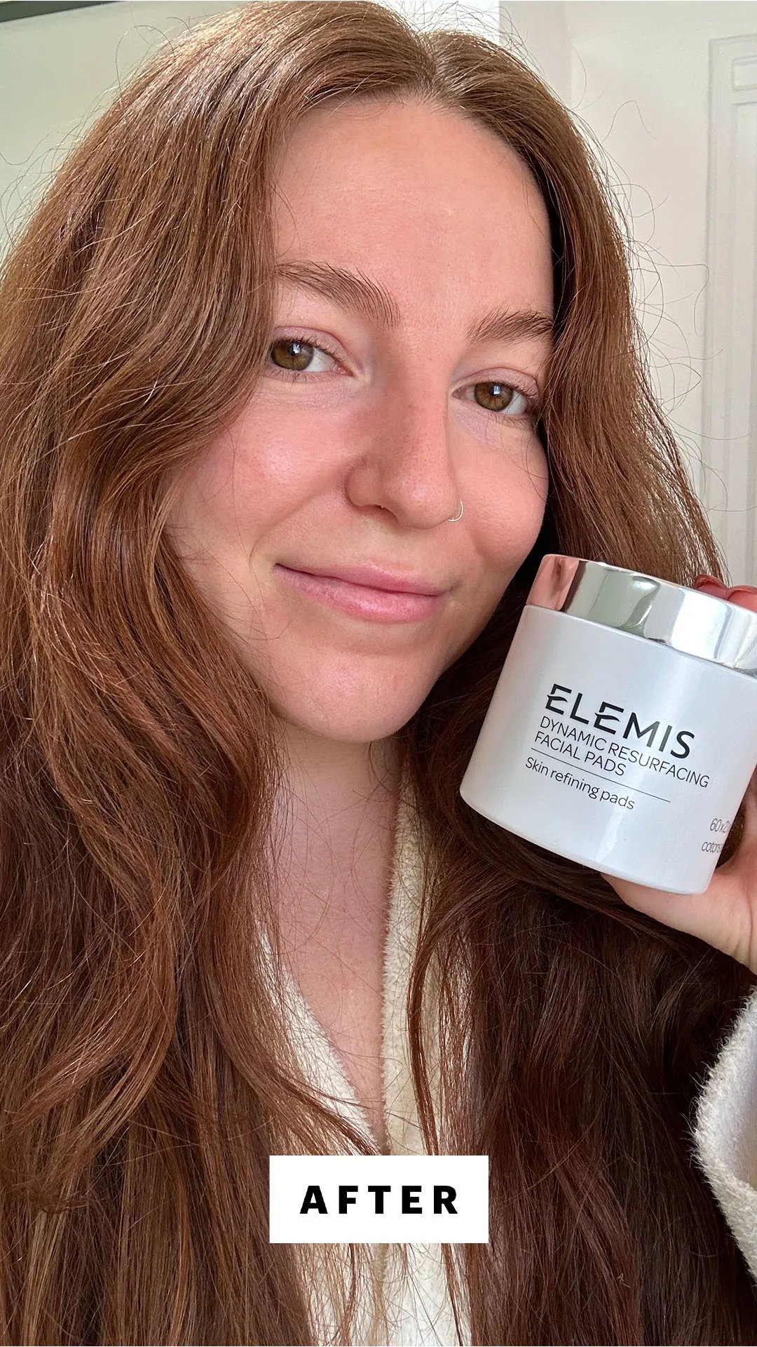 Allure senior staff writer Elizabeth Gulino after using the Elemis Dynamic Resurfacing Facial Pads