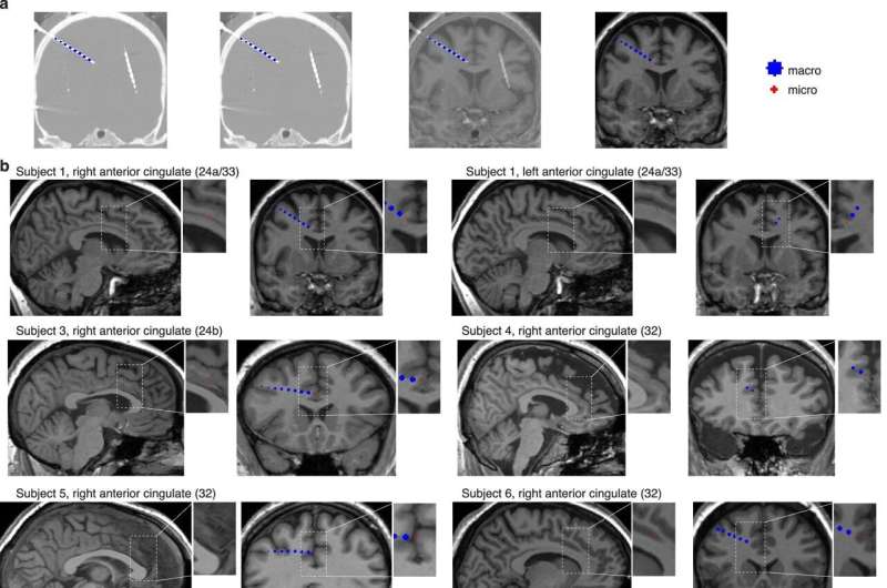 A poorly understood brain region tracks the gap between expectations and reality