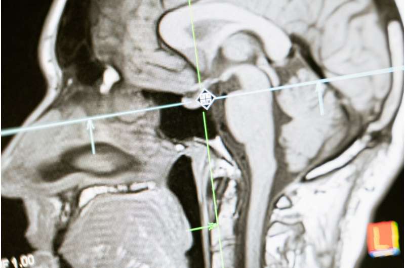 amygdala