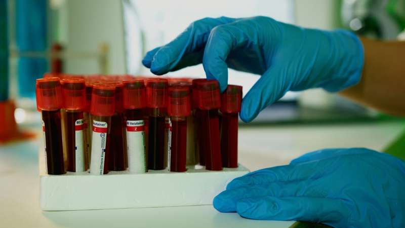 blood test