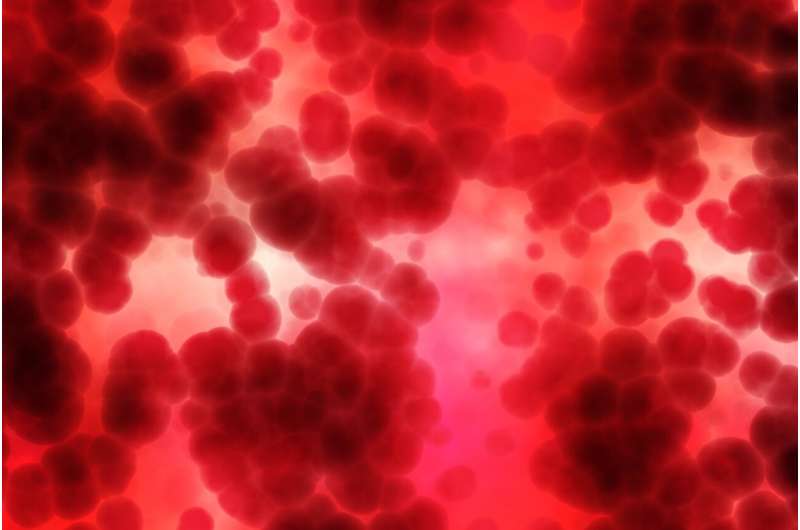 Credit: Pixabay/CC0 Public Domain blood