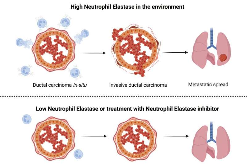 Discovery could help predict which early breast cancers will spread