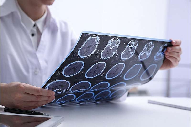 Early MS Treatments Impact Relapses And Brain Scarring Differently, But Not Disability