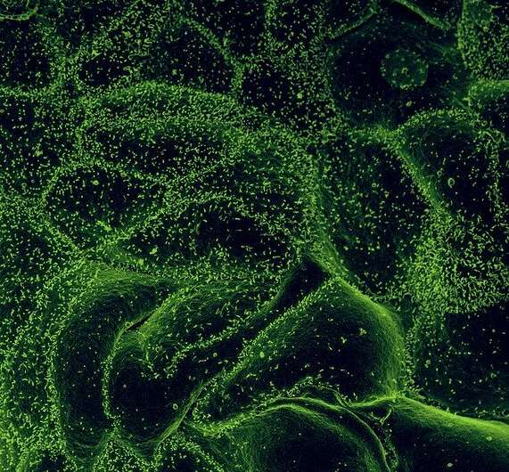 Ebola