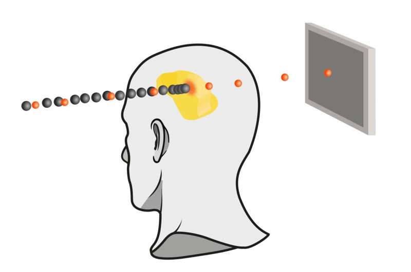 Ion beams against cancer