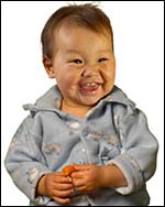 measles_large