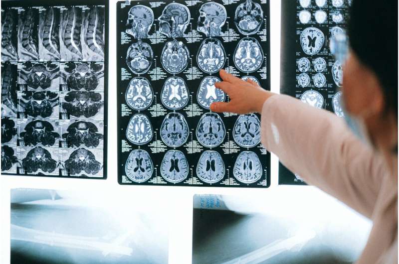 Credit: Anna Shvets from Pexels mri brain