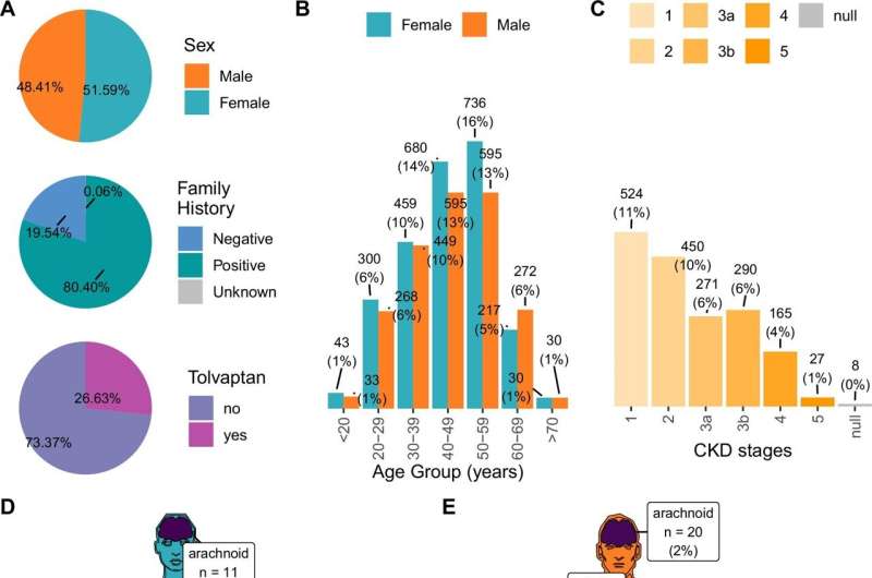 New platform provides real-time data to help research and treat polycystic kidney disease