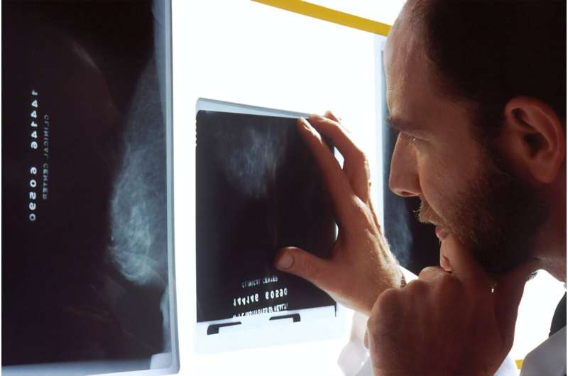 breast cancer