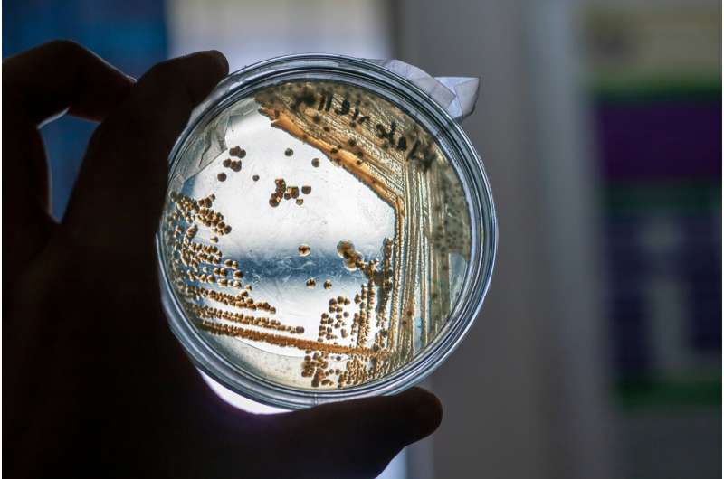 Credit: Unsplash/CC0 Public Domain S. aureus petri dish