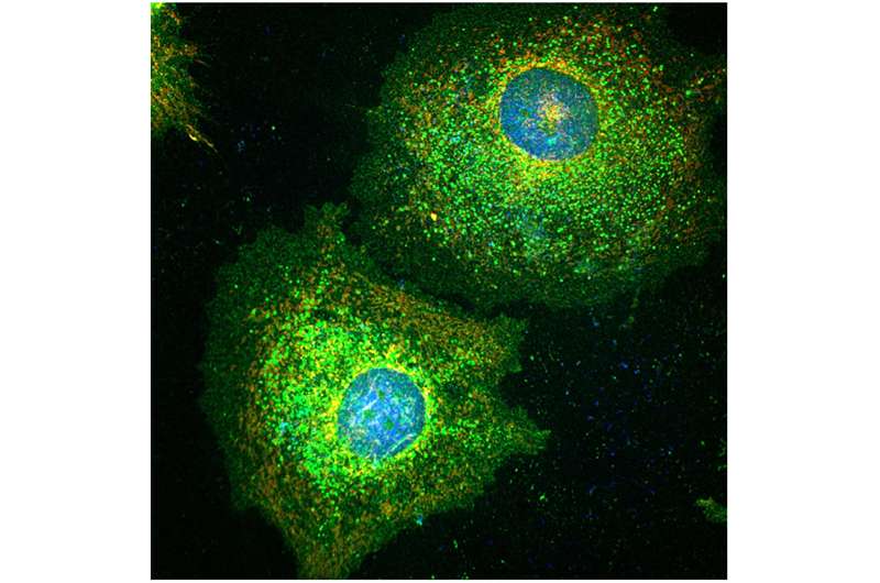 Scientists discover how cancers evade chemotherapy by entering 'Zombie-like state'